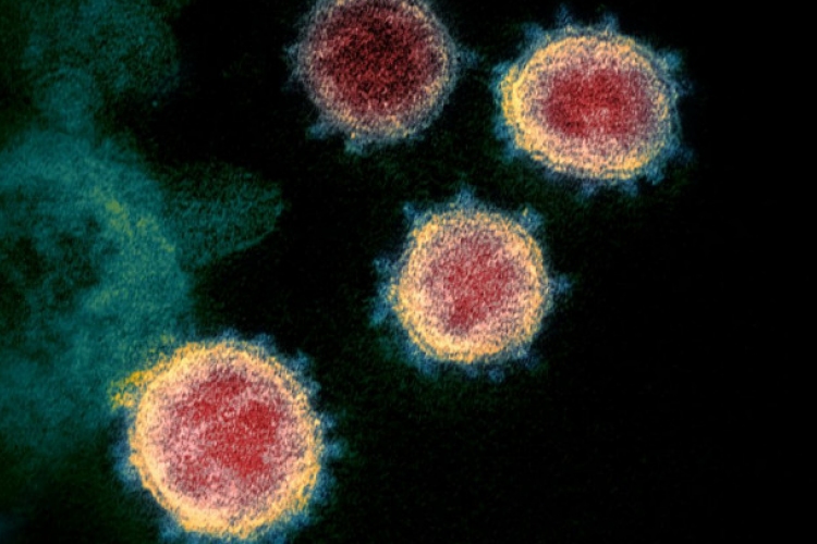 Koronavírus: Az enyhébb koronavírus-fertőzés jóval kisebb immunitást idéz elő