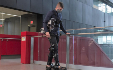Intelligens protéziseket fejleszt a Waterlooi Egyetem